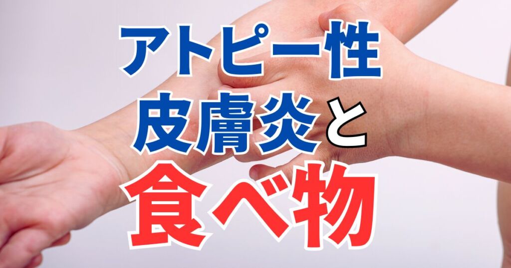アトピー性皮膚炎と食べ物｜アトピーの原因を知って改善しよう！