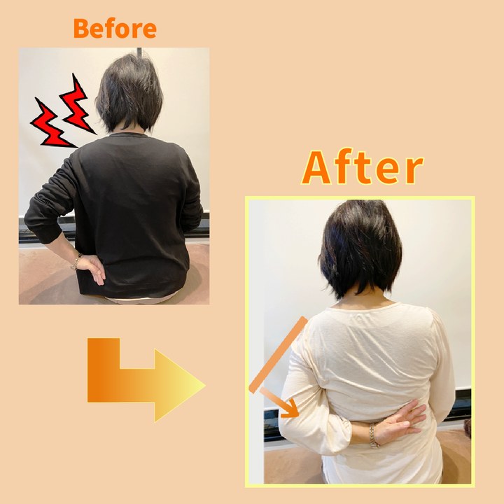 施術を受けた方の変化（一例・効果には個人差があります）