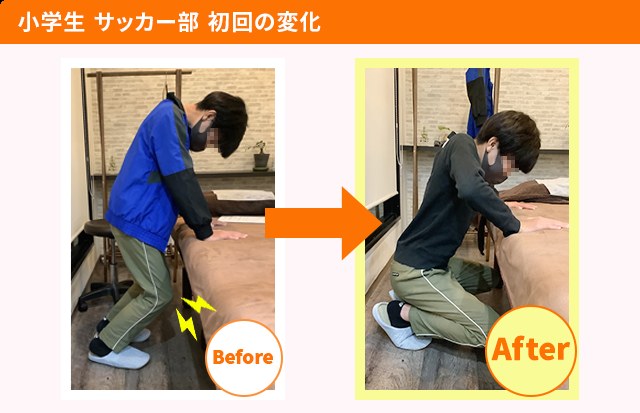 施術を受けた方の変化（一例・効果には個人差があります）